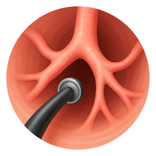 Бронхоскопия